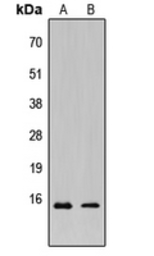 Anti-KCNE1L antibody used in Western Blot (WB). GTX56058