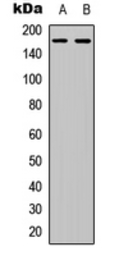 Anti-COL4A6 antibody used in Western Blot (WB). GTX56141