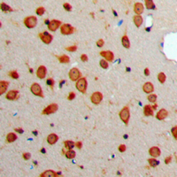 Anti-Somatostatin antibody used in IHC (Paraffin sections) (IHC-P). GTX56172