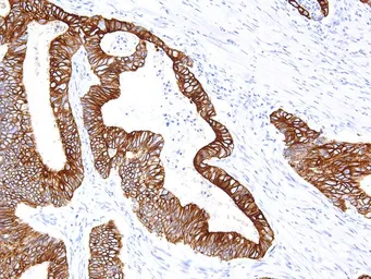 Anti-Cytokeratin 18 antibody [IHC018] used in IHC (Paraffin sections) (IHC-P). GTX57172