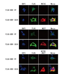 Anti-SOD1 (mutant) antibody [MS785] used in Immunocytochemistry/ Immunofluorescence (ICC/IF). GTX57211