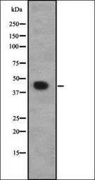 Anti-CACNG8 antibody used in Western Blot (WB). GTX57219