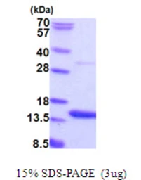 Human AAMDC protein, His tag. GTX57537-pro