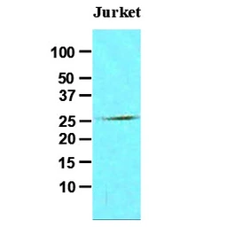 Anti-FADD antibody [J1D2] used in Western Blot (WB). GTX57546