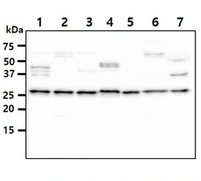 Anti-FADD antibody [J1D2] used in Western Blot (WB). GTX57546