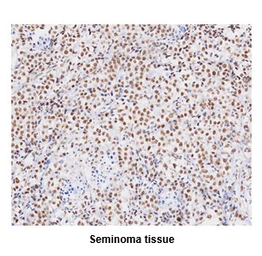 Anti-TDP43 antibody [k1B9] used in IHC (Paraffin sections) (IHC-P). GTX57560