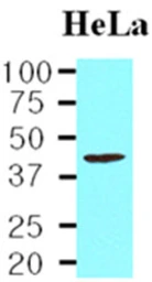 Anti-TDP43 antibody [k1B9] used in Western Blot (WB). GTX57560