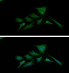 Anti-PKM antibody [AT1B10] used in Immunocytochemistry/ Immunofluorescence (ICC/IF). GTX57604