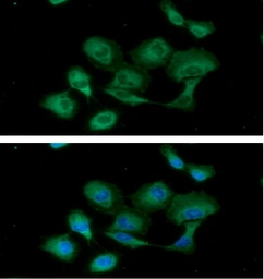 Anti-PKM antibody [AT1B10] used in Immunocytochemistry/ Immunofluorescence (ICC/IF). GTX57604