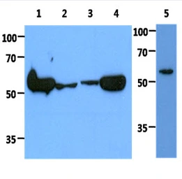 Anti-PKM antibody [AT1B10] used in Western Blot (WB). GTX57604