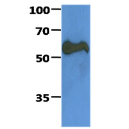 Anti-PKM antibody [AT1B10] used in Western Blot (WB). GTX57604