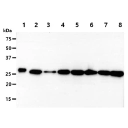 Anti-PGAM2 antibody [AT5A7] used in Western Blot (WB). GTX57652