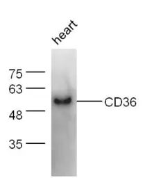 Anti-CD36 antibody used in Western Blot (WB). GTX60300