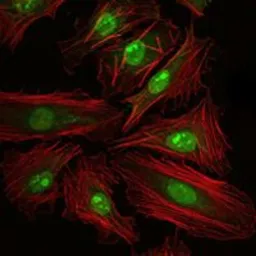 Anti-CREB antibody [5G3] used in Immunocytochemistry/ Immunofluorescence (ICC/IF). GTX60431