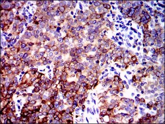 Anti-PPP2R4 antibody [4D9] used in IHC (Paraffin sections) (IHC-P). GTX60539