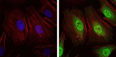 Anti-NEDD8 antibody [1A7] used in Immunocytochemistry/ Immunofluorescence (ICC/IF). GTX60545