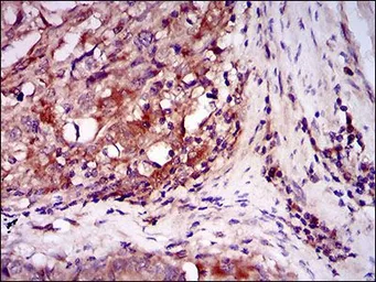 Anti-ILK antibody [3A9] used in IHC (Paraffin sections) (IHC-P). GTX60645