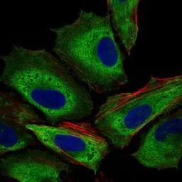 Anti-IL3 Receptor alpha antibody [8E11C5] used in Immunocytochemistry/ Immunofluorescence (ICC/IF). GTX60786