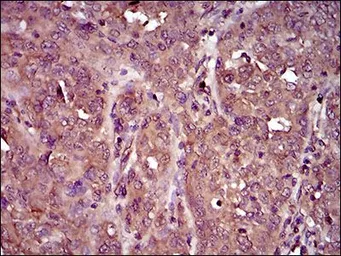 Anti-IL3 Receptor alpha antibody [8E11C5] used in IHC (Paraffin sections) (IHC-P). GTX60786