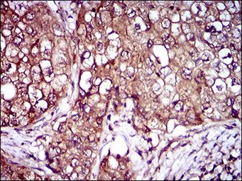 Anti-IL3 Receptor alpha antibody [8E11C5] used in IHC (Paraffin sections) (IHC-P). GTX60786