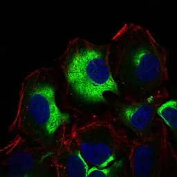 Anti-IL3 Receptor alpha antibody [10B8E7] used in Immunocytochemistry/ Immunofluorescence (ICC/IF). GTX60797