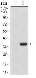 Anti-IL3 Receptor alpha antibody [10B8E7] used in Western Blot (WB). GTX60797