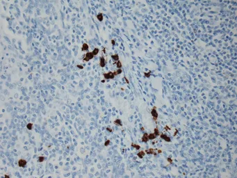 Rabbit Anti-Human IgG3 antibody [RM119]. GTX60864