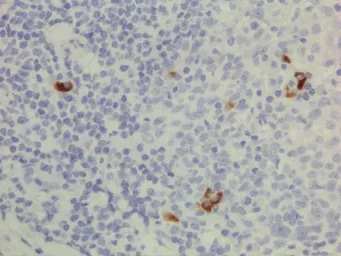 Rabbit Anti-Human IgG3 antibody [RM119]. GTX60864