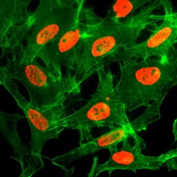 Anti-Histone H3K14ac (Acetyl Lys14) antibody [RM130] used in Immunocytochemistry/ Immunofluorescence (ICC/IF). GTX60874