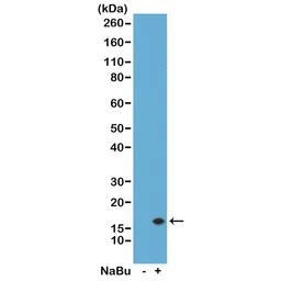 Anti-Histone H3K14ac (Acetyl Lys14) antibody [RM130] used in Western Blot (WB). GTX60874