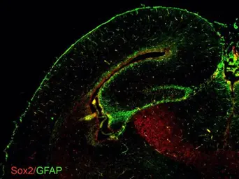 Anti-SOX2 antibody [GT1876] used in IHC (Frozen sections) (IHC-Fr). GTX627404