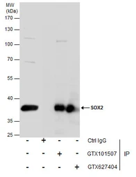 Anti-SOX2 antibody [GT1876] used in Immunoprecipitation (IP). GTX627404