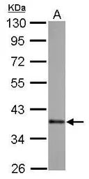 Anti-SOX2 antibody [GT1876] used in Western Blot (WB). GTX627404