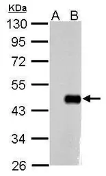 Anti-Oct4 antibody [GT486] used in Western Blot (WB). GTX627419