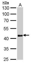 Anti-Oct4 antibody [GT486] used in Western Blot (WB). GTX627419