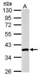 Anti-Nanog antibody [GT3312] used in Western Blot (WB). GTX627421