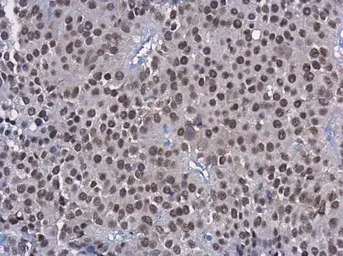 Anti-HNF1 alpha antibody [GT4110] used in IHC (Paraffin sections) (IHC-P). GTX628240