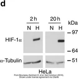 Anti-HIF1 alpha antibody [GT10211] used in Western Blot (WB). GTX628480