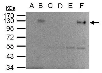 Anti-HIF1 alpha antibody [GT10211] used in Immunoprecipitation (IP). GTX628480