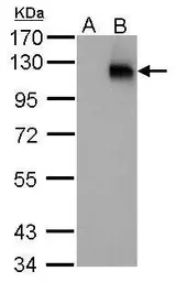 Anti-HIF1 alpha antibody [GT10211] used in Western Blot (WB). GTX628480