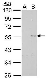 Anti-Cyclin B1 antibody [GT238] used in Western Blot (WB). GTX628546