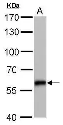 Anti-CBS antibody [GT519] used in Western Blot (WB). GTX628777