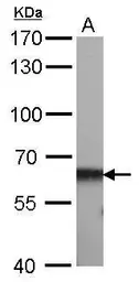 Anti-CBS antibody [GT519] used in Western Blot (WB). GTX628777