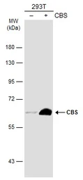 Anti-CBS antibody [GT519] used in Western Blot (WB). GTX628777