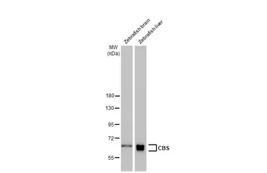 Anti-CBS antibody [GT519] used in Western Blot (WB). GTX628777