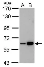 Anti-CBS antibody [GT519] used in Western Blot (WB). GTX628777