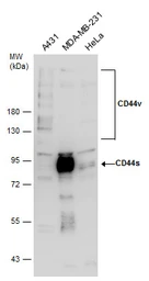 Anti-CD44 antibody [GT462] used in Western Blot (WB). GTX628895