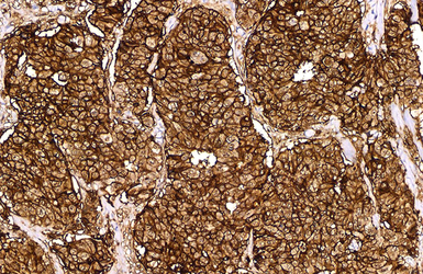 Anti-CD44 antibody [GT462] used in IHC (Paraffin sections) (IHC-P). GTX628895