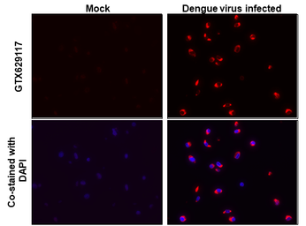 Anti-Dengue virus Envelope protein antibody [GT643] used in IHC-P (cell pellet) (IHC-P (cell pellet)). GTX629117