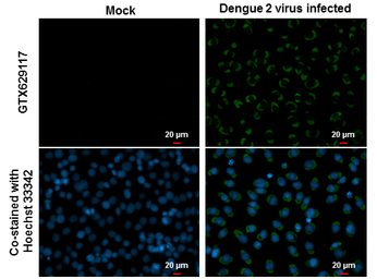 Anti-Dengue virus Envelope protein antibody [GT643] used in Immunocytochemistry/ Immunofluorescence (ICC/IF). GTX629117